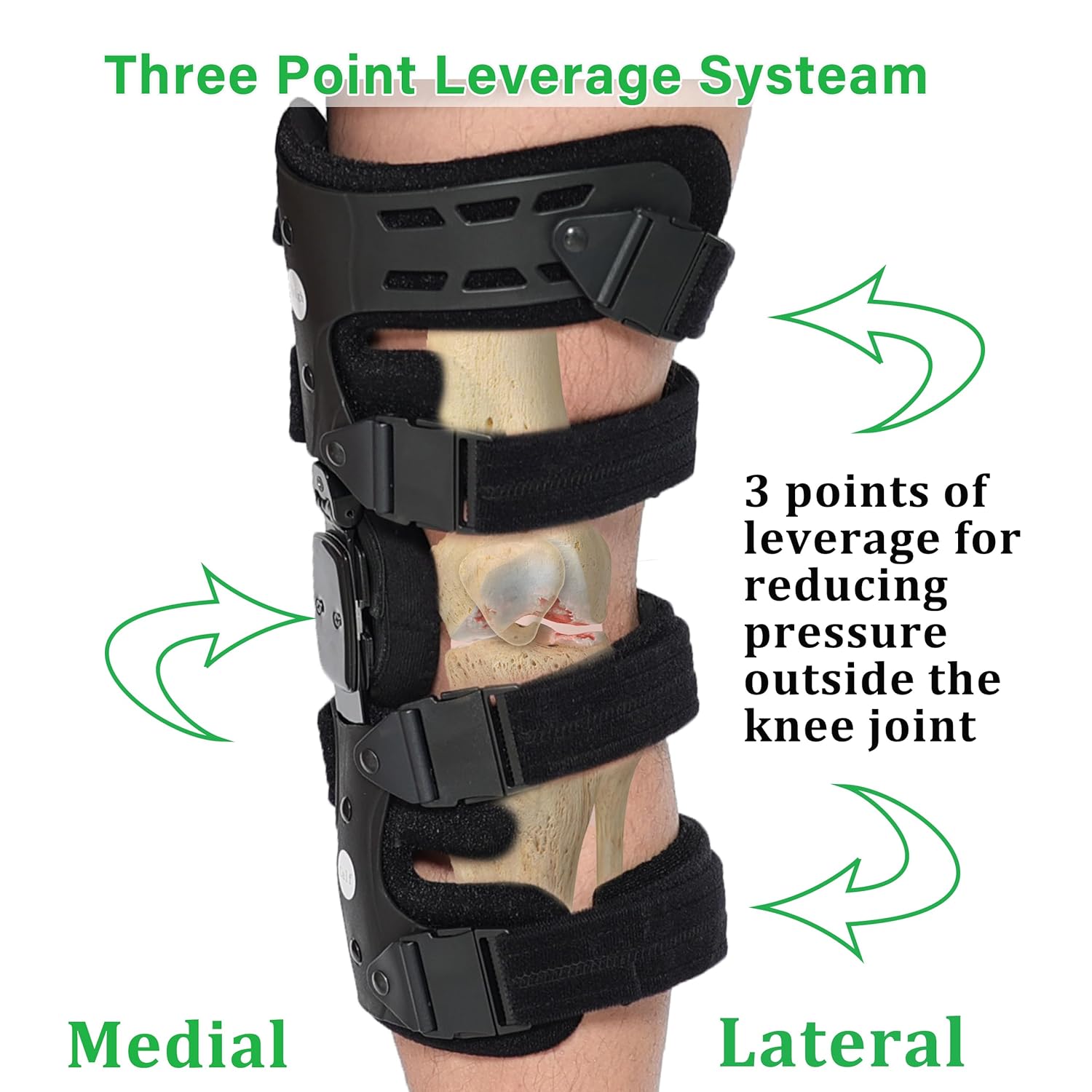 Lateral Unloader Knee Brace for Osteoarthritis, Arthritis Knee Pain Relief, Bone on Bone Joint Degeneration Offloader